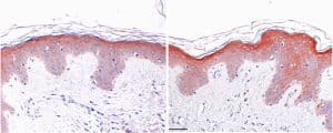 Increase in epidermal thickness with continued use of the serum