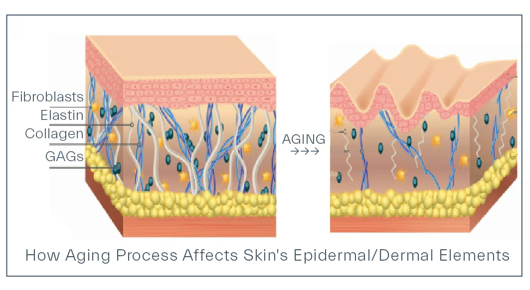 how aging changes the skin
