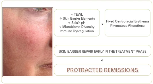 skin barrier deficiency in rosacea