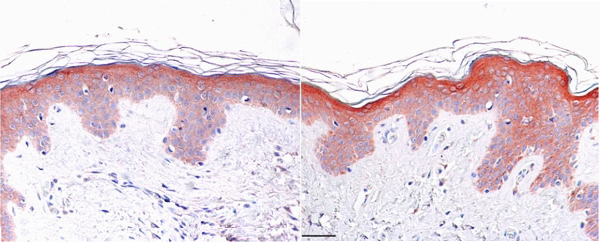 Increase in epidermal thickness is observed from left to right with continued use of the serum