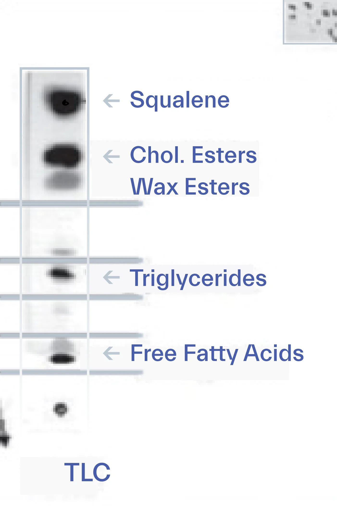 dermatology of oily skin