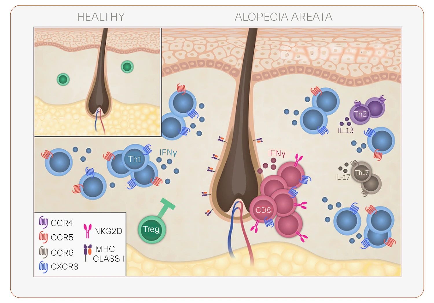 CD4 and CD8 Tcells activation in alopecia areata