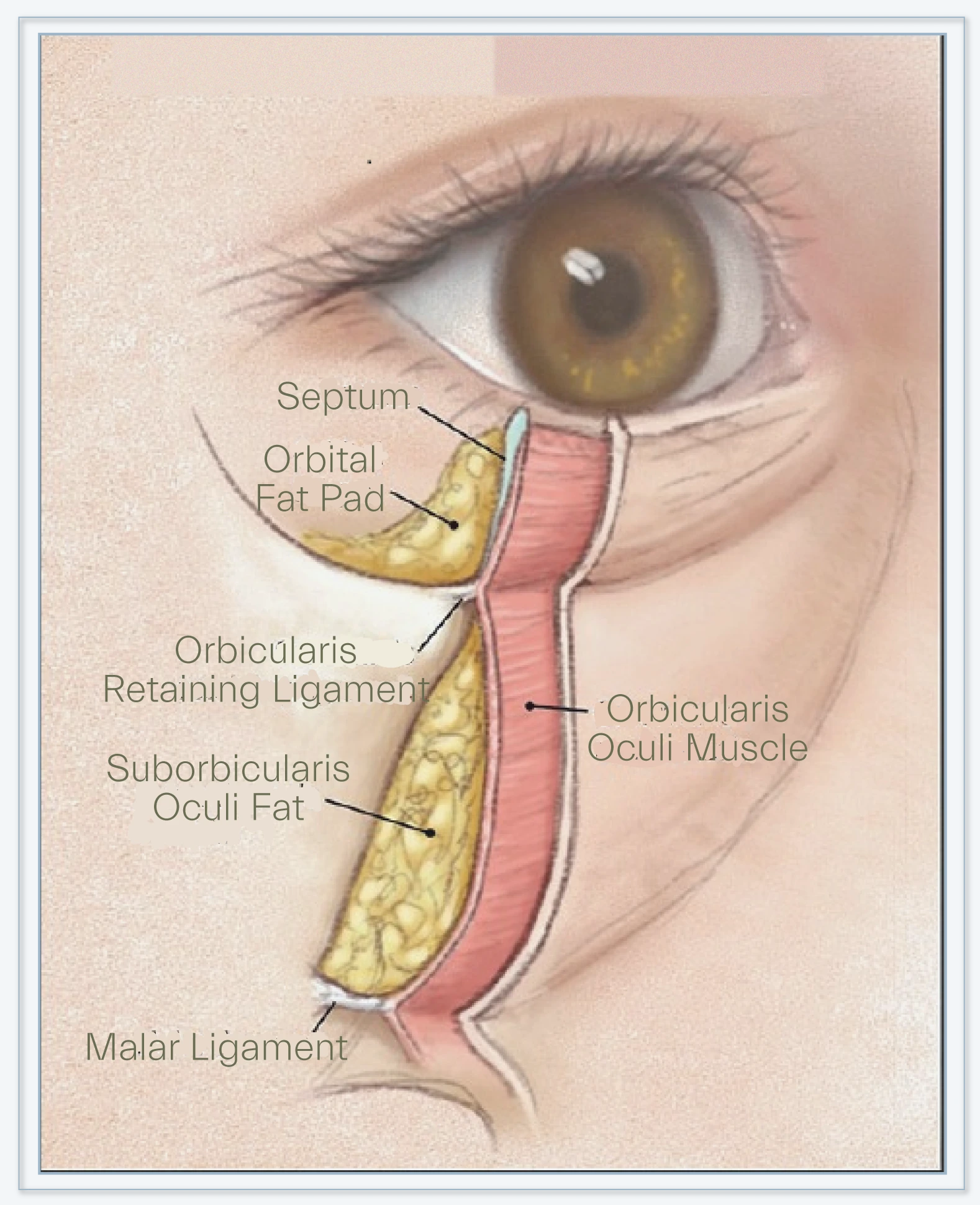Aging skin and soft tissue changes in lower eyelid
