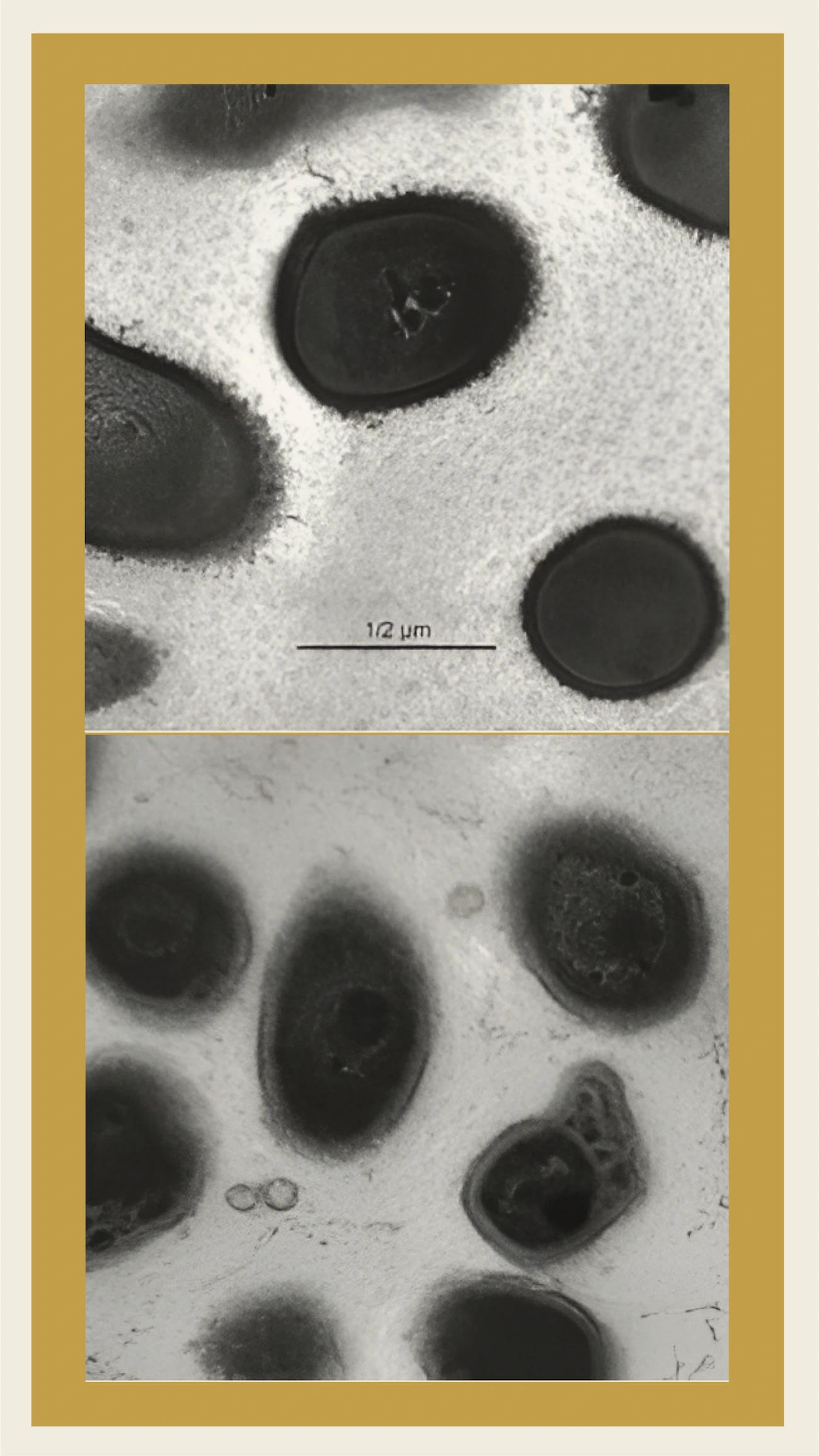 Transformation in bacterial structures under effect of resveratrol