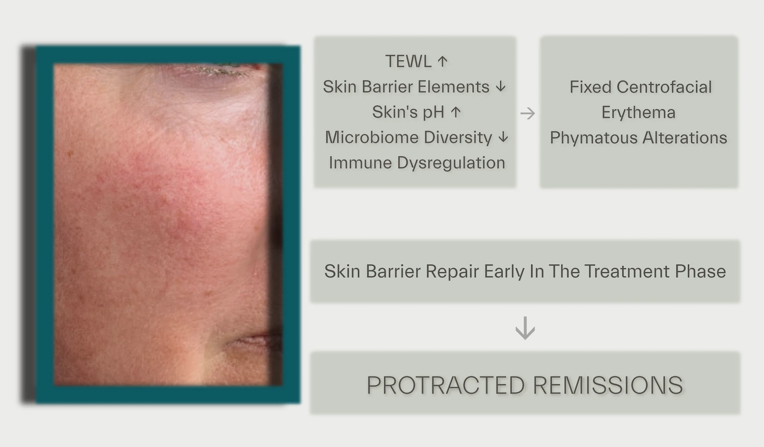 - Maintenance treatment cognizant to skin barrier function